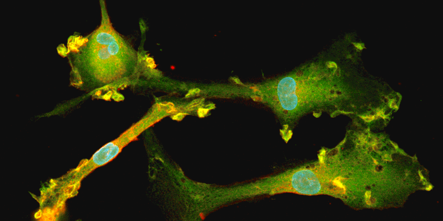 The Emerging Role Of Microglia In Alzheimer's Disease